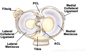 Torn Meniscus - Repair and Post Op Instructions - Connecticut