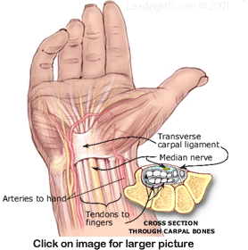 Carpal Tunnel